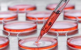 آشنایی با اصول عملی کشت سلول در دانشگاه علوم پزشکی قزوین