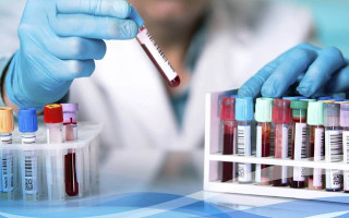 تخفیف ۲۰ درصدی خدمات آزمایشگاهی آزمایشگاه جامع تحقیقات علوم پزشکی تبریز