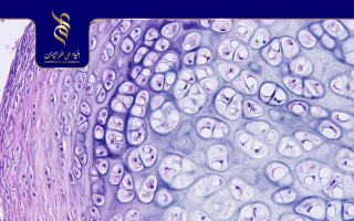 روش انتقال سلول بنیادی برای ترمیم بافت غضروف در ایران بهبود یافت