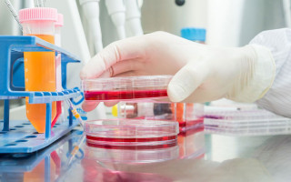 ارتقای دقت آزمون‌های میکروبی با اجرای استاندارد 9899