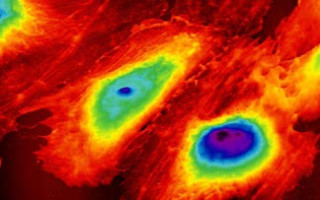 کاربرد میکروسکوپ نیروی اتمی در تحقیقات زیستی؛ با مروری بر کاربرد آن در دندانپزشکی محافظه کارانه و اندودنتیکس